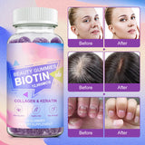 biotin gummies